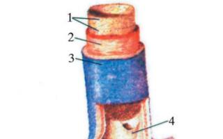 Варикозная болезнь ног: анатомия, клиника, диагностика и методы лечения