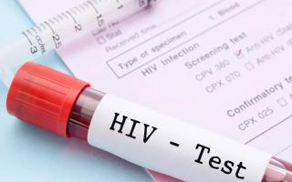 Анализы на ВИЧ-инфекцию: особенности процедуры и расшифровка результатов При вич лимфоциты повышены или понижены