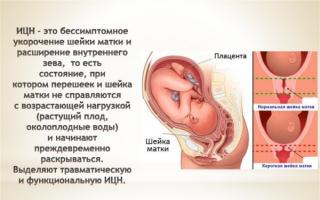 Причины тонуса матки, симптомы в разных триместрах беременности, способы его самостоятельного снятия в домашних условиях