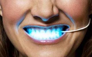 Отбеливаем зубы в домашних условиях Легкое отбеливание зубов